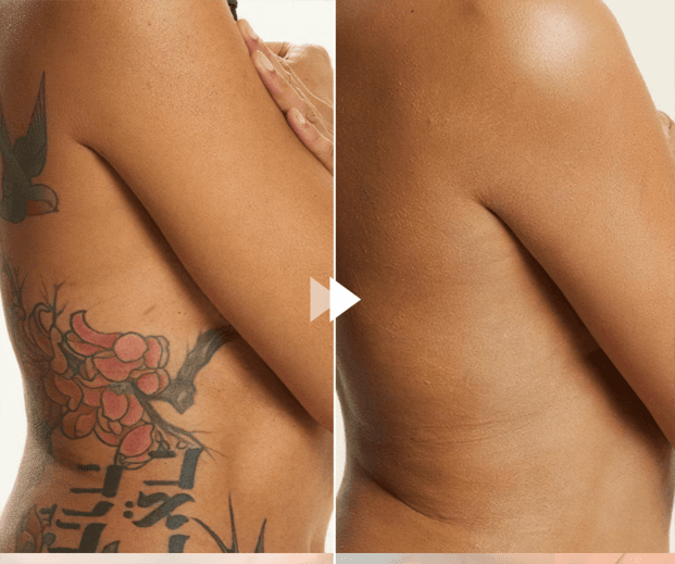 Before and after — tattoo covered with Perfect Concealer